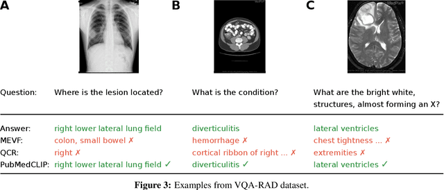 Figure 4 for Does CLIP Benefit Visual Question Answering in the Medical Domain as Much as it Does in the General Domain?