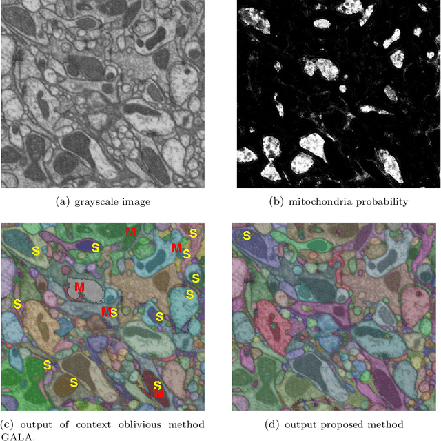 Figure 1 for A Context-aware Delayed Agglomeration Framework for Electron Microscopy Segmentation