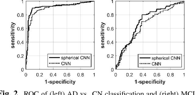 Figure 3 for Discriminative analysis of the human cortex using spherical CNNs - a study on Alzheimer's disease diagnosis