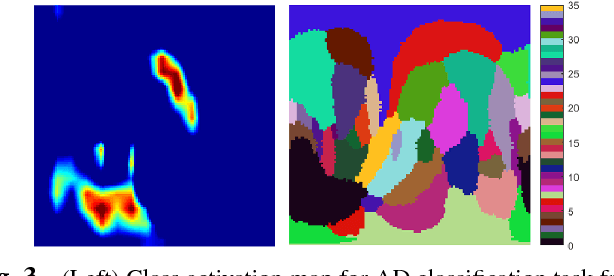 Figure 4 for Discriminative analysis of the human cortex using spherical CNNs - a study on Alzheimer's disease diagnosis