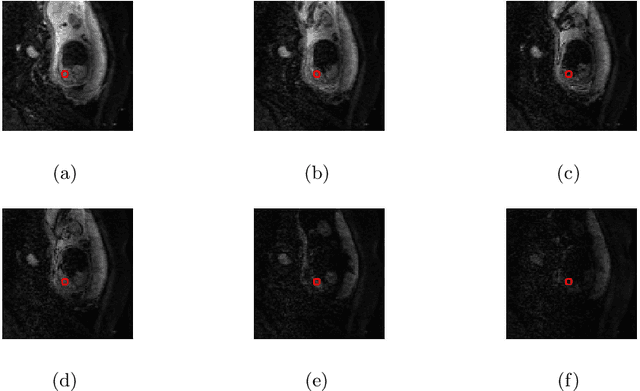 Figure 4 for qDWI-Morph: Motion-compensated quantitative Diffusion-Weighted MRI analysis for fetal lung maturity assessment