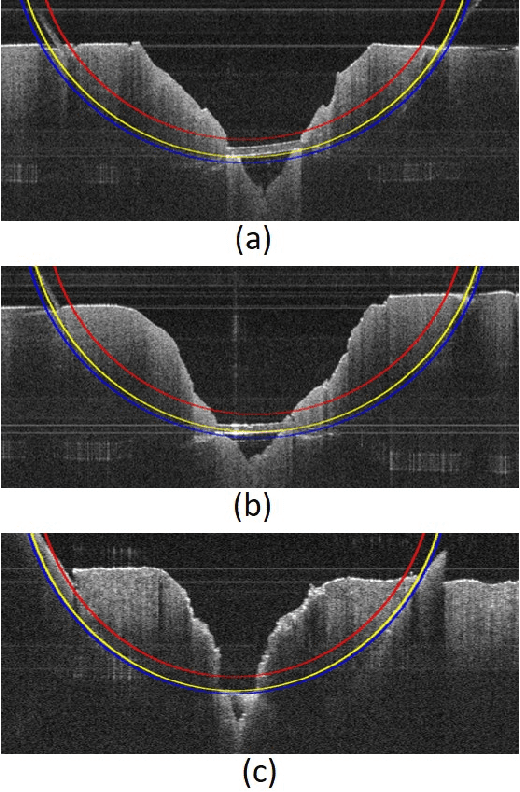 Figure 2 for Toward Autonomous Robotic Micro-Suturing using Optical Coherence Tomography Calibration and Path Planning