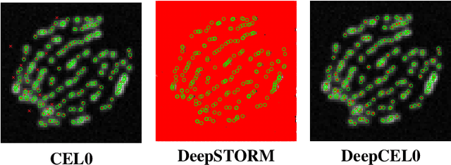 Figure 2 for DeepCEL0 for 2D Single Molecule Localization in Fluorescence Microscopy