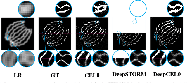 Figure 3 for DeepCEL0 for 2D Single Molecule Localization in Fluorescence Microscopy