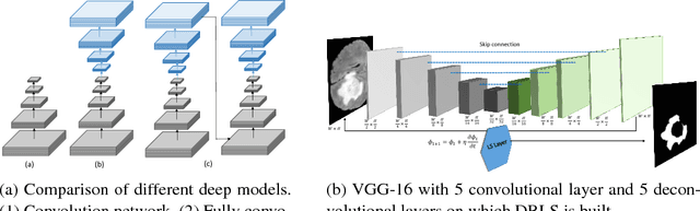 Figure 3 for Deep Recurrent Level Set for Segmenting Brain Tumors