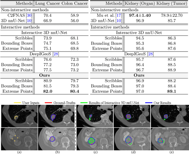 Figure 2 for Quality-Aware Memory Network for Interactive Volumetric Image Segmentation