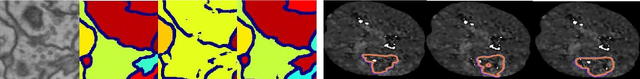 Figure 1 for High-level Prior-based Loss Functions for Medical Image Segmentation: A Survey