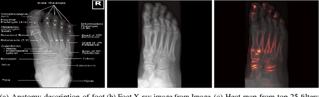 Figure 1 for Understanding Anatomy Classification Through Attentive Response Maps