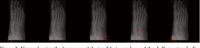 Figure 4 for Understanding Anatomy Classification Through Attentive Response Maps