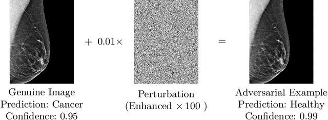 Figure 1 for Impact of Adversarial Examples on Deep Learning Models for Biomedical Image Segmentation