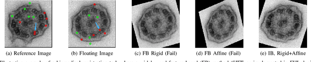 Figure 1 for Fast and Robust Symmetric Image Registration Based on Intensity and Spatial Information