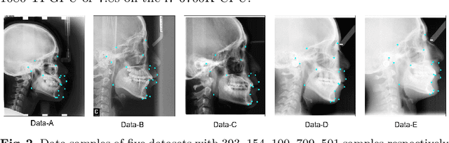 Figure 4 for Cephalometric Landmark Detection by AttentiveFeature Pyramid Fusion and Regression-Voting