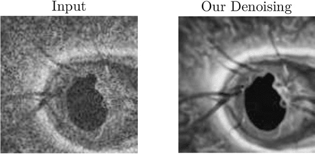 Figure 1 for Self-supervised Denoising via Diffeomorphic Template Estimation: Application to Optical Coherence Tomography