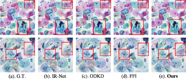 Figure 4 for Deep Semi-supervised Knowledge Distillation for Overlapping Cervical Cell Instance Segmentation