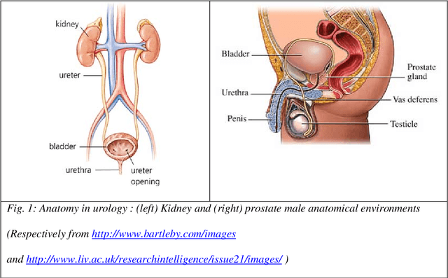 Figure 1 for Medical image computing and computer-aided medical interventions applied to soft tissues. Work in progress in urology