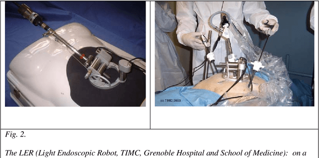 Figure 2 for Medical image computing and computer-aided medical interventions applied to soft tissues. Work in progress in urology