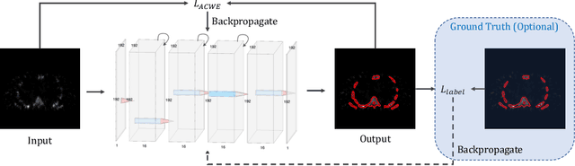 Figure 1 for An Unsupervised Learning Model for Medical Image Segmentation