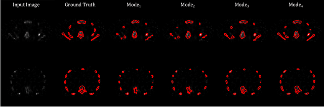 Figure 2 for An Unsupervised Learning Model for Medical Image Segmentation