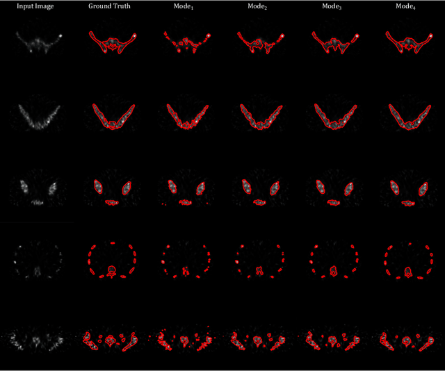 Figure 3 for An Unsupervised Learning Model for Medical Image Segmentation