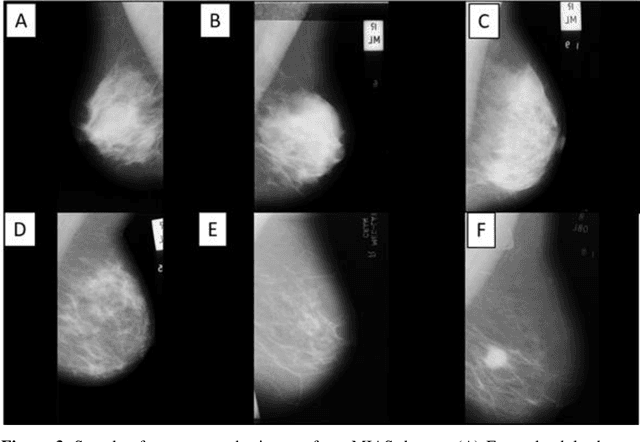 Figure 4 for Reduction of Surgical Risk Through the Evaluation of Medical Imaging Diagnostics