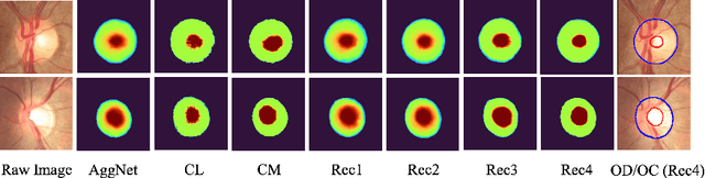 Figure 3 for Learning self-calibrated optic disc and cup segmentation from multi-rater annotations