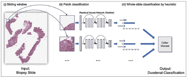 Figure 1 for Diagnosis and Analysis of Celiac Disease and Environmental Enteropathy on Biopsy Images using Deep Learning Approaches
