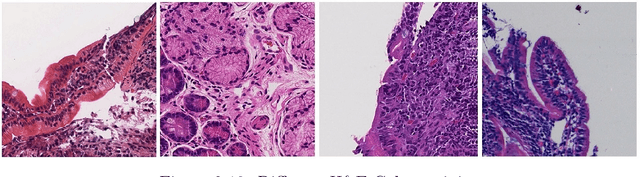 Figure 2 for Diagnosis and Analysis of Celiac Disease and Environmental Enteropathy on Biopsy Images using Deep Learning Approaches