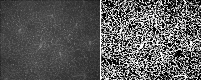 Figure 4 for An Analysis of the Influence of Transfer Learning When Measuring the Tortuosity of Blood Vessels