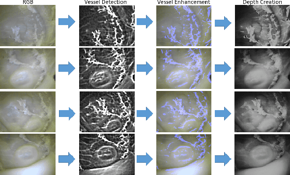 Figure 4 for Magnetic-Visual Sensor Fusion-based Dense 3D Reconstruction and Localization for Endoscopic Capsule Robots