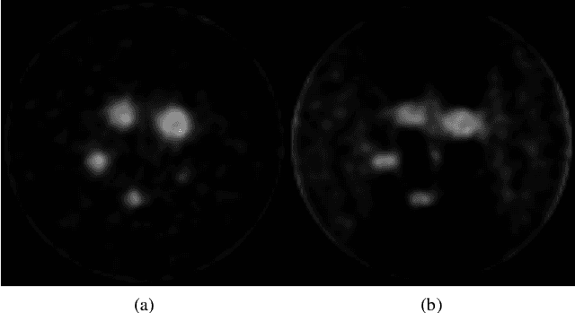 Figure 4 for Automatic Channel Fault Detection and Diagnosis System for a Small Animal APD-Based Digital PET Scanner