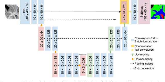 Figure 1 for U-SegNet: Fully Convolutional Neural Network based Automated Brain tissue segmentation Tool