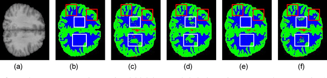 Figure 3 for U-SegNet: Fully Convolutional Neural Network based Automated Brain tissue segmentation Tool