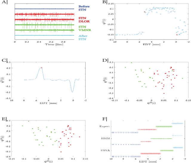 Figure 4 for Unsupervised Detection of Sub-Territories of the Subthalamic Nucleus During DBS Surgery with Manifold Learning