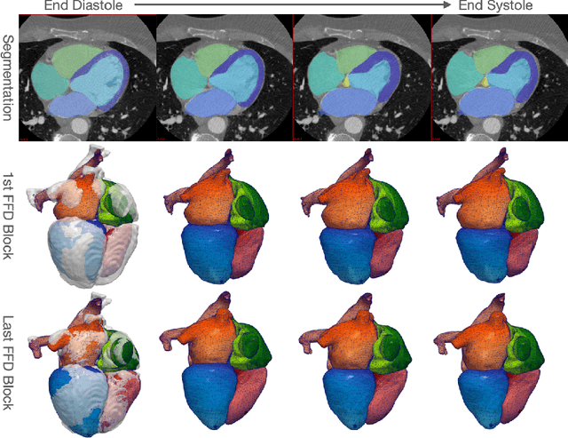 Figure 4 for Whole Heart Mesh Generation For Image-Based Computational Simulations By Learning Free-From Deformations