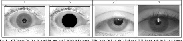 Figure 3 for Relevant features for Gender Classification in NIR Periocular Images