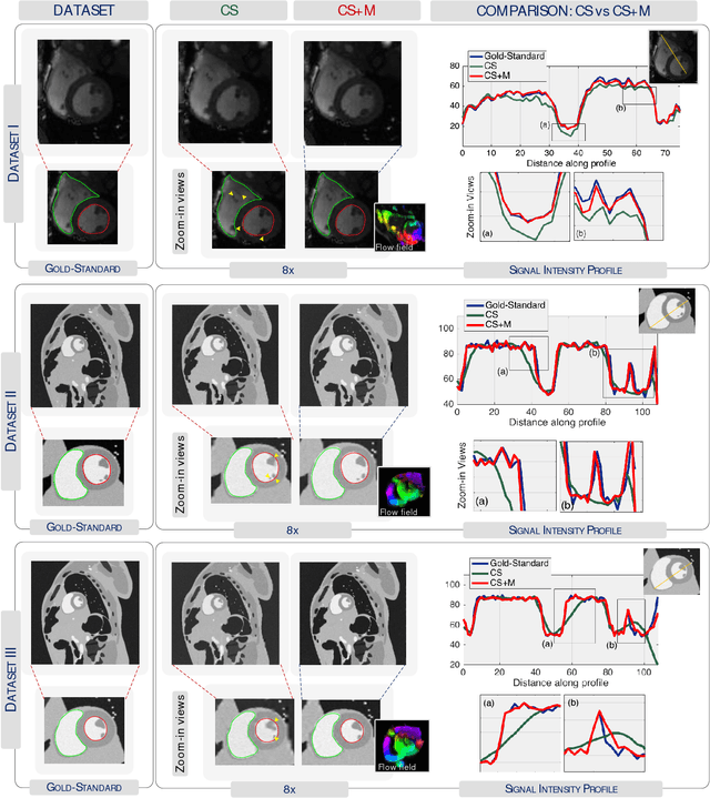 Figure 4 for Compressed Sensing Plus Motion (CS+M): A New Perspective for Improving Undersampled MR Image Reconstruction