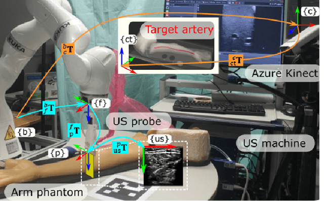 Figure 3 for Precise Repositioning of Robotic Ultrasound: Improving Registration-based Motion Compensation using Ultrasound Confidence Optimization