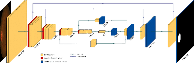 Figure 3 for Utilizing Transfer Learning and a Customized Loss Function for Optic Disc Segmentation from Retinal Images