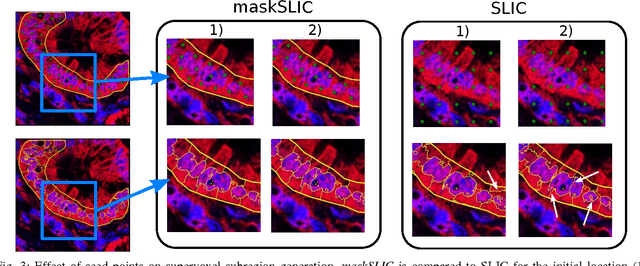 Figure 3 for maskSLIC: Regional Superpixel Generation with Application to Local Pathology Characterisation in Medical Images