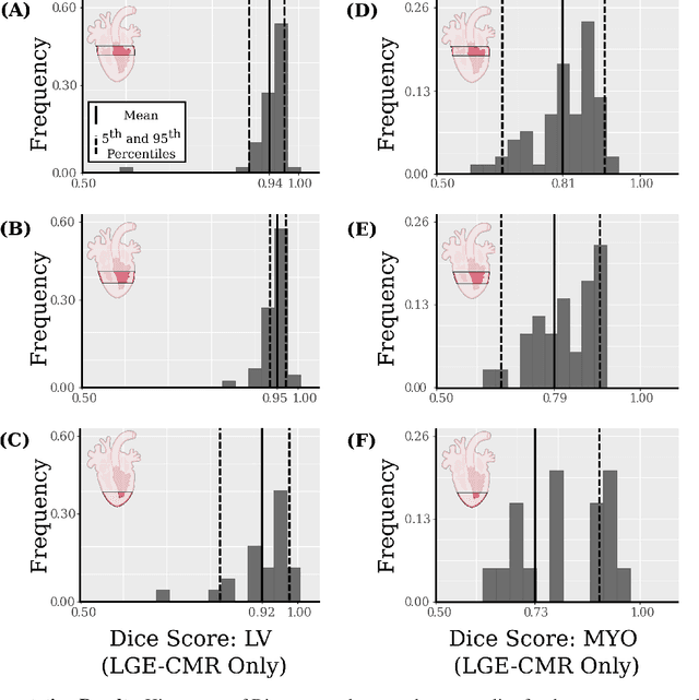 Figure 3 for Anatomically-Informed Deep Learning on Contrast-Enhanced Cardiac MRI for Scar Segmentation and Clinical Feature Extraction