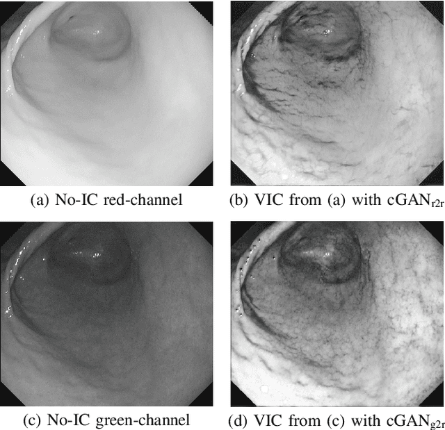 Figure 2 for Stomach 3D Reconstruction Based on Virtual Chromoendoscopic Image Generation