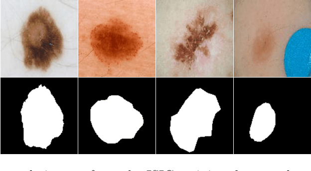 Figure 1 for Mask2Lesion: Mask-Constrained Adversarial Skin Lesion Image Synthesis