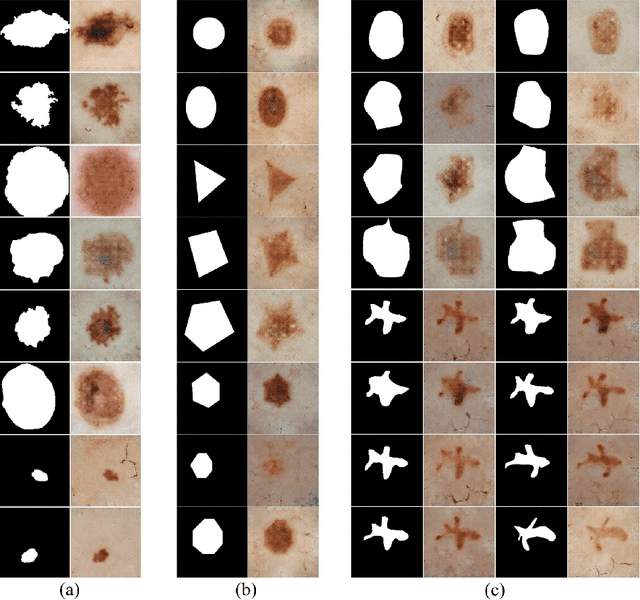 Figure 3 for Mask2Lesion: Mask-Constrained Adversarial Skin Lesion Image Synthesis