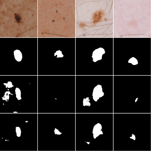 Figure 4 for Mask2Lesion: Mask-Constrained Adversarial Skin Lesion Image Synthesis