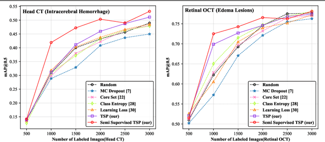 Figure 2 for Semi-supervised Active Learning for Instance Segmentation via Scoring Predictions