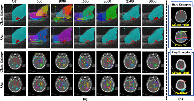 Figure 3 for Semi-supervised Active Learning for Instance Segmentation via Scoring Predictions