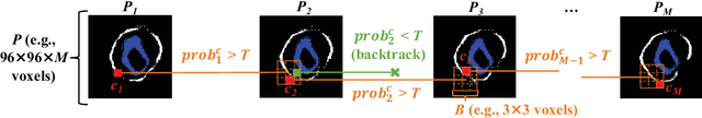 Figure 3 for Plaque segmentation via masking of the artery wall