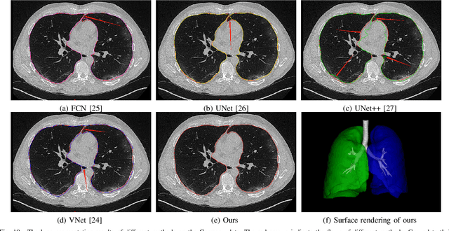 Figure 2 for COVID-19 Chest CT Image Segmentation -- A Deep Convolutional Neural Network Solution