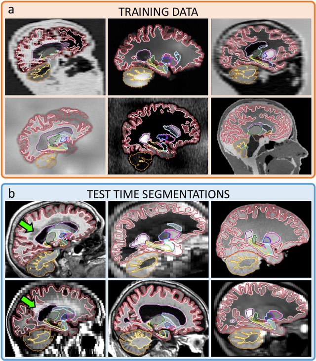Figure 1 for SynthSeg: Domain Randomisation for Segmentation of Brain MRI Scans of any Contrast and Resolution