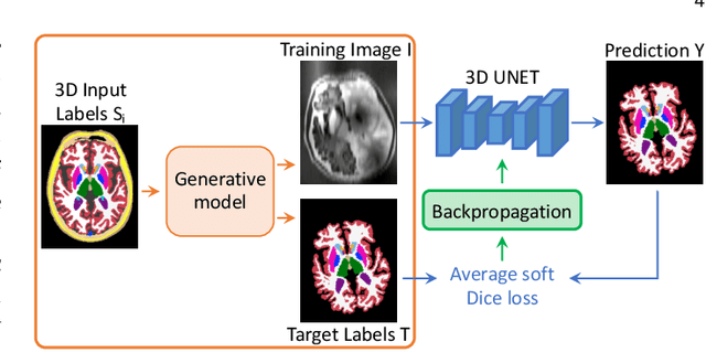 Figure 3 for SynthSeg: Domain Randomisation for Segmentation of Brain MRI Scans of any Contrast and Resolution